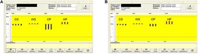 The Use of Quantitative Sensation Testing to Identify the Physiological Differences Between the Median and Ulnar Nerves